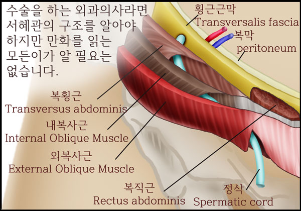 닥터단감 “갑자기 거기로 뭐가 튀어나와요!!” - 탈장