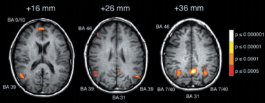 사진_An fMRI Investigation of Emotional Engagement in Moral Judgment (논문)